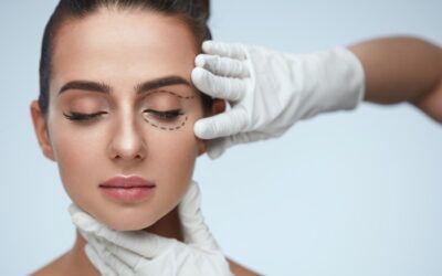 The Ultimate Guide to the Surgical Process of Blepharoplasty